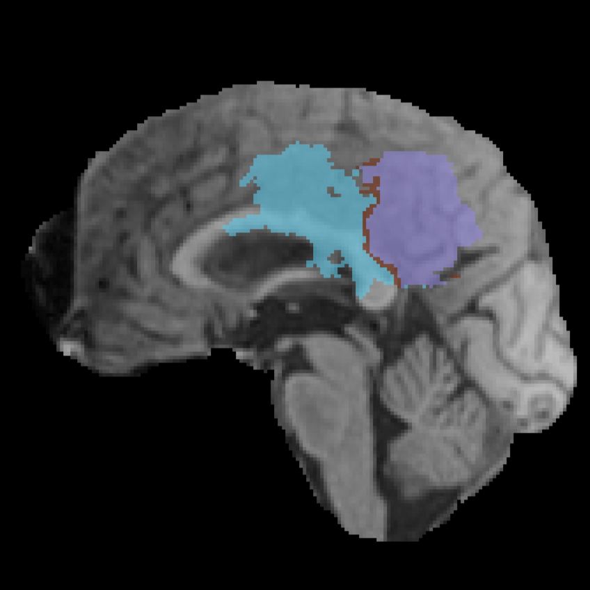Example T1 MRI sequence
