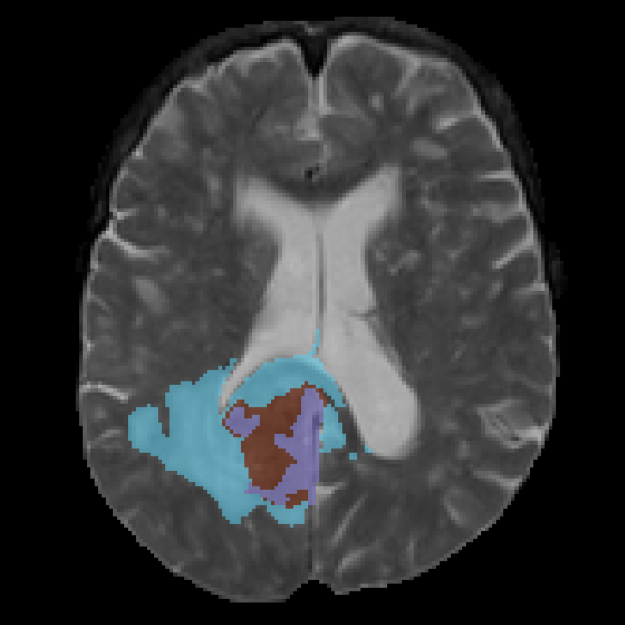 Example T2 MRI sequence