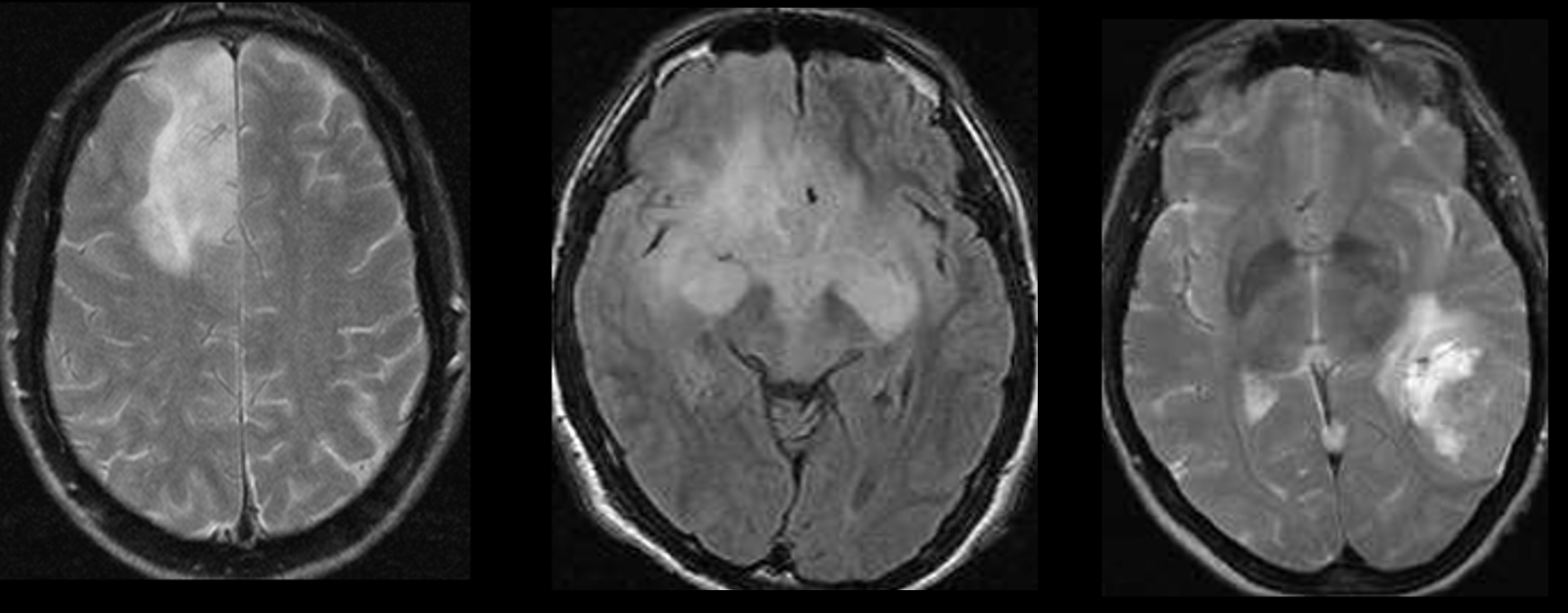 F003 – Side of Tumor Center